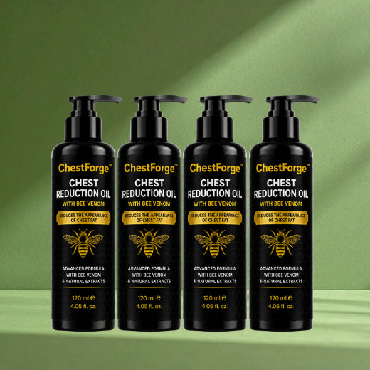 ChestForge™